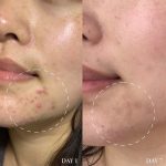 سرم ضد لک و جوش اکسیس وای AXIS-Y مدل Spot the Difference Blemish Treatment حجم 15 میلی لیتر - تصویر 4