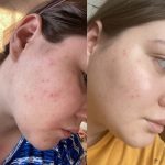 تونر ضدلک، روشن کننده و لایه بردار گلیکولیک اسید 7٪ اوردینری Ordinary حجم 240 میلی لیتر - تصویر 2